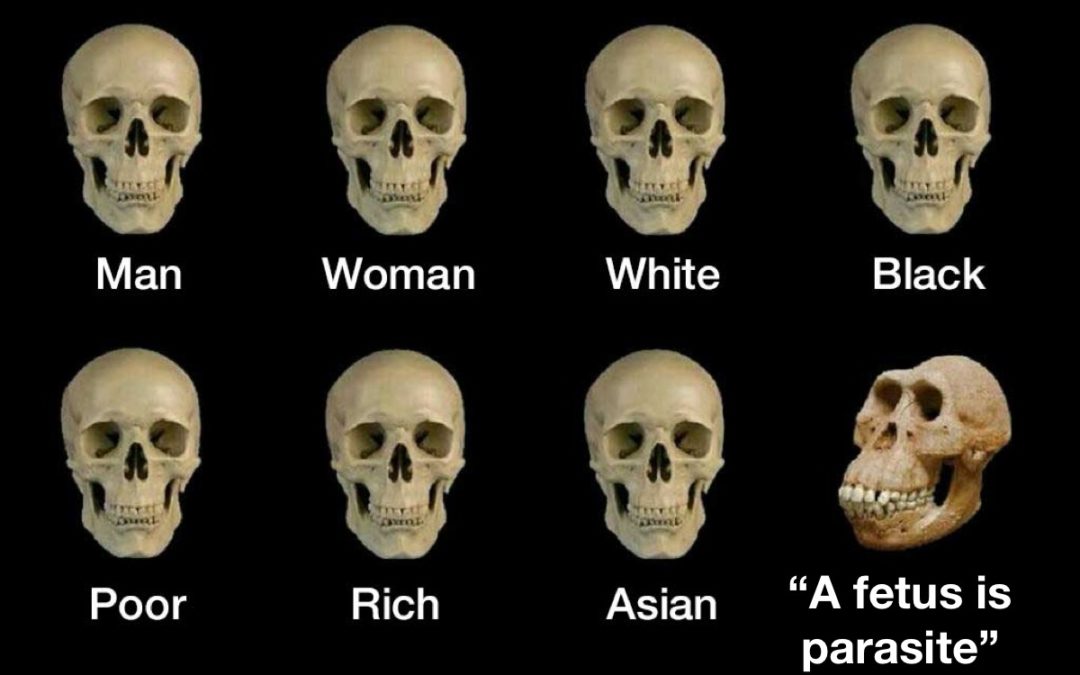 Skulls Fetus Is A Parasite
