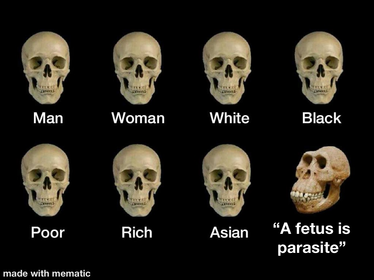 Skulls Fetus Is A Parasite